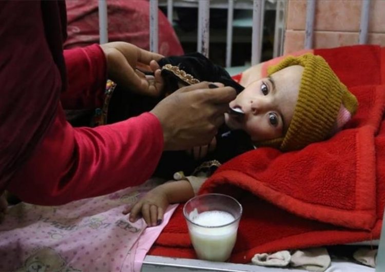 افزایش سوءتغذیه کودکان در تخار؛ 11 کودک طی یک ماه جان باخته‌اند